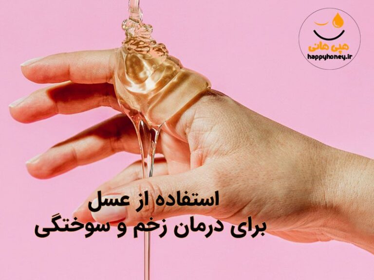 درمان سوختگی با عسل