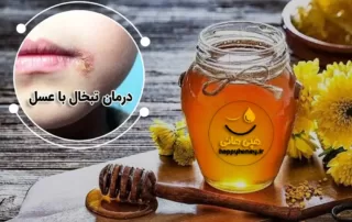 درمان تبخال با عسل طبیعی