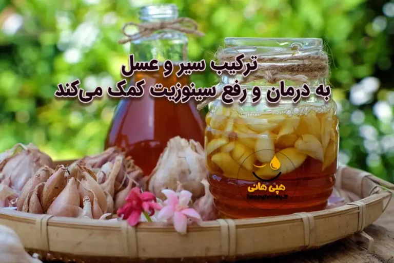 سیر و عسل برای سینوزیت