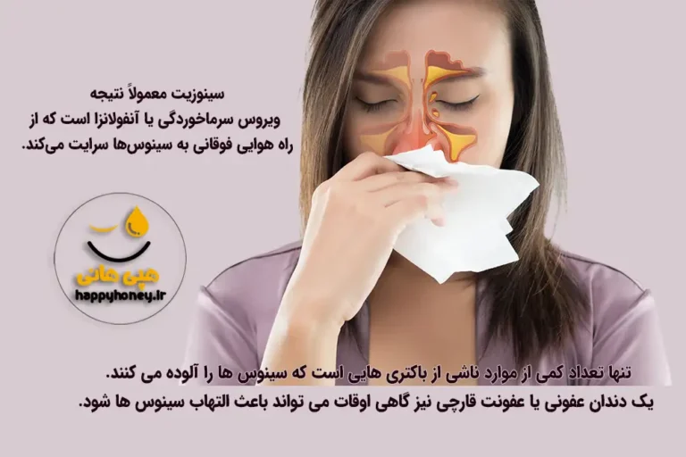 درمان خانگی سینوزیت